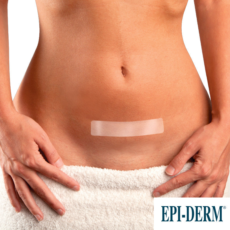EPIDERM EDG -1000 LÁMINA DE SILICONA 14.5 X 3.5 CM